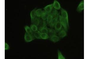 Detection of TUBb in Human MCF7 Cell using Polyclonal Antibody to Tubulin Beta (TUBb) (TUBB 抗体  (AA 170-419))