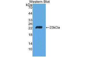 Western Blotting (WB) image for anti-CD6 (CD6) (AA 30-204) antibody (ABIN2118641) (CD6 抗体  (AA 30-204))