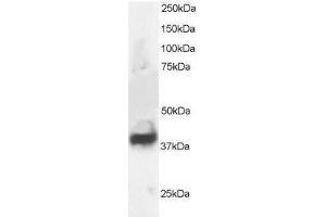 Image no. 1 for anti-Septin 3 (SEPT3) (N-Term) antibody (ABIN374202) (Septin 3 抗体  (N-Term))