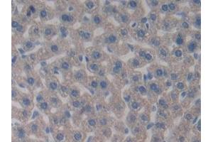 Immunohistochemistry (IHC) image for anti-Pyruvate Dehydrogenase Complex, Component X (PDHX) (AA 222-471) antibody (ABIN7443338)