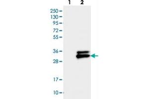 Western blot analysis of Lane 1: Negative control (vector only transfected HEK293T lysate), Lane 2: Over-expression Lysate (Co-expressed with a C-terminal myc-DDK tag (~3. (TMEM176A 抗体)