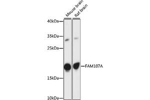 Western blot analysis of extracts of various cell lines, using FA antibody (ABIN7267100) at 1:1000 dilution. (FAM107A 抗体  (AA 1-144))