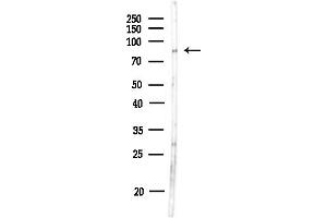 Western blot analysis of lysates from MDA-MB-231 cells(heat-shock,45 min treatment), using NKRF Antibody at 1/1000 dilution.