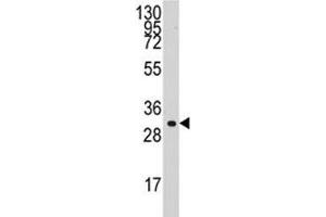 Western blot analysis of Cyclin C antibody and HL-60 lysate. (Cyclin C 抗体  (AA 221-249))