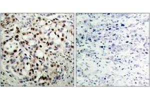 Immunohistochemistry (IHC) image for anti-cAMP Responsive Element Binding Protein 1 (CREB1) (AA 100-149), (pSer133) antibody (ABIN1531812)