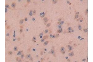 Immunohistochemistry (IHC) image for anti-Galanin (GAL) (AA 36-123) antibody (ABIN7429748)