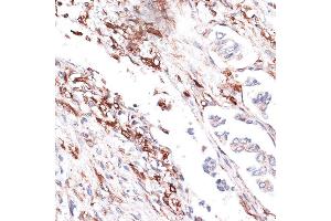 Immunohistochemistry (IHC) image for anti-Vimentin (VIM) (AA 1-200) antibody (ABIN3016292)
