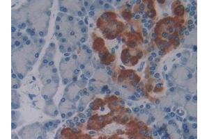 Immunohistochemistry (IHC) image for anti-Secreted phosphoprotein 1 (SPP1) (AA 17-317) antibody (ABIN7443842)