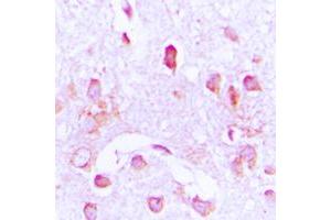 Immunohistochemical analysis of CDC37 staining in human brain formalin fixed paraffin embedded tissue section.