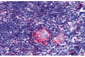 Anti-LPAR6 / P2RY5 antibody  ABIN1049020 IHC staining of human thymus. (LPAR6 抗体  (Extracellular Domain))
