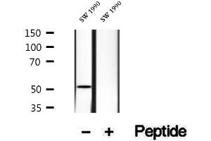 Western blot analysis of extracts of SW 1990 cells, using HERP antibody. (HERPUD1 抗体  (N-Term))