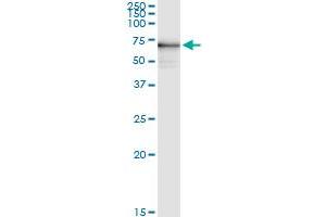 Immunoprecipitation of PKLR transfected lysate using anti-PKLR MaxPab rabbit polyclonal antibody and Protein A Magnetic Bead , and immunoblotted with PKLR purified MaxPab mouse polyclonal antibody (B01P) . (PKLR 抗体  (AA 1-574))
