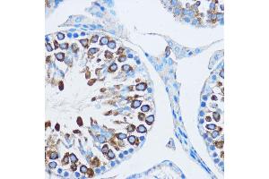 Immunohistochemistry of paraffin-embedded mouse testis using YB-1/YB-1/YBX1 antibody (ABIN6134494, ABIN6150328, ABIN6150330 and ABIN7101815) at dilution of 1:100 (40x lens). (YBX1 抗体  (AA 100-200))