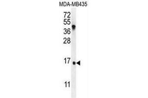 IGKV A18 Antibody (C-term) western blot analysis in MDA-MB435 cell line lysates (35µg/lane). (IGKV A18 抗体  (C-Term))