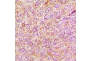 Immunohistochemistry (IHC) image for anti-Proteasome (Prosome, Macropain) 26S Subunit, Non-ATPase, 9 (PSMD9) antibody (ABIN7308242) (PSMD9 抗体)