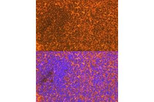 Immunofluorescence analysis of mouse spleen using CD83 Rabbit mAb (ABIN7266223) at dilution of 1:100 (40x lens). (CD83 抗体)