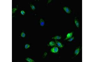 Immunofluorescent analysis of Hela cells using ABIN7161785 at dilution of 1:100 and Alexa Fluor 488-congugated AffiniPure Goat Anti-Rabbit IgG(H+L) (NFAT5 抗体  (AA 1422-1531))