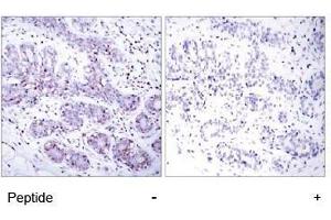 Image no. 1 for anti-Signal Transducer and Activator of Transcription 4 (STAT4) (Tyr693) antibody (ABIN197178)