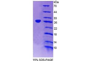 SDS-PAGE analysis of Human SSA1 Protein. (TRIM21 蛋白)