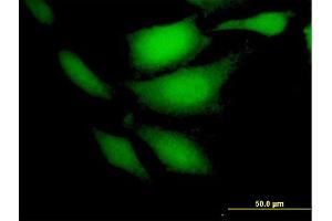 Immunofluorescence of purified MaxPab antibody to CDKN2C on HeLa cell. (CDKN2C 抗体  (AA 1-168))