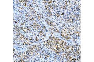 IHC analysis of AGR2 using anti-AGR2 antibody (ABIN5518726).