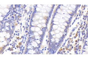 Detection of MT1 in Human Colon Tissue using Polyclonal Antibody to Metallothionein 1 (MT1) (MT1 抗体  (AA 1-61))