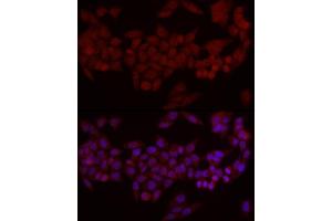 Immunofluorescence analysis of HeLa cells using Smad7 Rabbit pAb (ABIN6133913, ABIN6148093, ABIN6148095 and ABIN6215945) at dilution of 1:50 (40x lens). (SMAD7 抗体  (AA 1-100))