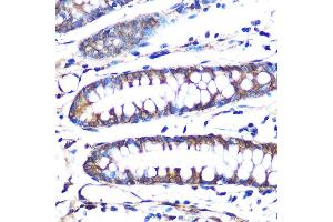 Immunohistochemistry of paraffin-embedded human colon using Aromatase (CYP19) Rabbit mAb (2238) at dilution of 1:100 (40x lens). (Aromatase 抗体)