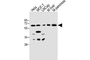All lanes : Anti-CBS Antibody (Center) at 1:500 dilution Lane 1: Hela whole cell lysate Lane 2: MCF-7 whole cell lysate Lane 3: LNCap whole cell lysate Lane 4: mouse liver lysate Lane 5: mouse pancreas lysate Lysates/proteins at 20 μg per lane. (CBS 抗体  (AA 301-330))
