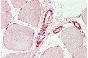anti-Inositol Polyphosphate-5-Phosphatase K (INPP5K) (AA 183-430) antibody