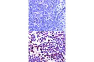 Noxa Immunohistochemistry. (NOXA 抗体)