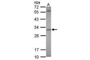 Image no. 1 for anti-Ankyrin Repeat and SOCS Box-Containing 12 (ASB12) (AA 38-303) antibody (ABIN1496738) (ASB12 抗体  (AA 38-303))