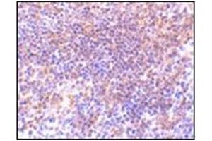Immunohistochemistry of PAK2 in mouse spleen tissue with this product at 10 μg/ml. (PAK2 抗体  (N-Term))