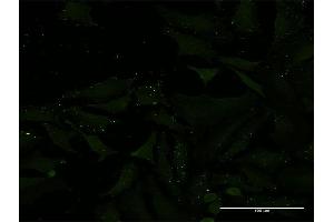 Immunofluorescence of monoclonal antibody to ADAMTS1 on HeLa cell. (ADAMTS1 抗体  (AA 858-967))