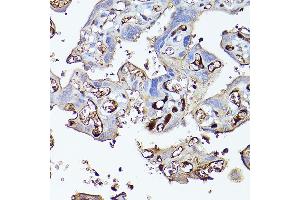 Immunohistochemistry of paraffin-embedded human placenta using Complement factor H Rabbit pAb (ABIN3023096, ABIN3023097, ABIN3023098 and ABIN6219387) at dilution of 1:100 (40x lens). (Complement Factor H 抗体  (AA 20-270))