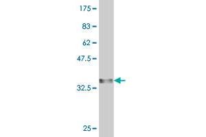 Western Blot detection against Immunogen (33. (AMY1A 抗体  (AA 172-245))