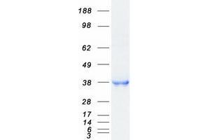 Validation with Western Blot