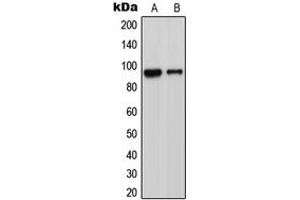 Western blot analysis of ADAM23 expression in Jurkat (A), MCF7 (B), Raw264.