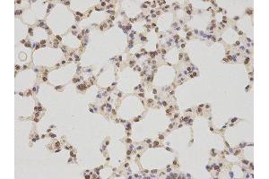 Immunohistochemistry (IHC) image for anti-Thymopoietin (TMPO) antibody (ABIN1875122) (Thymopoietin 抗体)