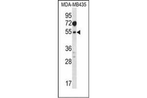 Western blot analysis of MAT1A Antibody (N-term) in MDA-MB435 cell line lysates (35ug/lane). (MAT1A 抗体  (N-Term))