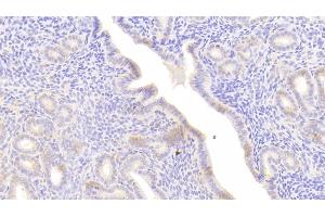 Detection of C1INH in Mouse Uterus Tissue using Polyclonal Antibody to Complement 1 Inhibitor (C1INH)