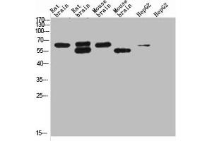 Western Blotting (WB) image for anti-Potassium Voltage-Gated Channel, Subfamily H (Eag-Related), Member 5 (KCNH5) antibody (ABIN7189251)