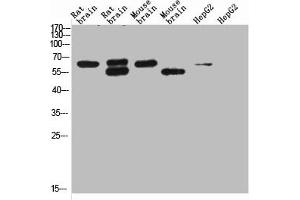 Western blot analysis of 1) Rat Brain Tissue-Low Molecular Protein Marker, 2)Rat Brain Tissue-High Molecular Protein Marker, 3) Mouse Brain Tissue-Low Molecular Protein Marker, 4) Mouse Brain Tissue- High Molecular Protein Marker, 5) HepG2-Low Molecular P