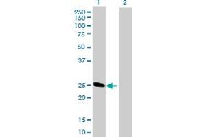 Western Blot analysis of BCAP29 expression in transfected 293T cell line by BCAP29 MaxPab polyclonal antibody. (BCAP29 抗体  (AA 1-241))