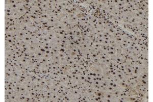 ABIN6267186 at 1/100 staining Mouse liver tissue by IHC-P. (SSH3 抗体  (pSer37))