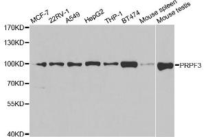 Western blot analysis of extracts of various cell lines, using PRPF3 antibody (ABIN5973192) at 1/1000 dilution. (PRPF3 抗体)