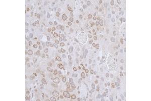 Immunohistochemistry (IHC) image for anti-LAP2 beta/tmpo (AA 225-275) antibody (ABIN7455055) (LAP2 beta/tmpo (AA 225-275) 抗体)
