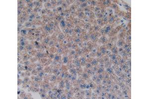 Used in DAB staining on fromalin fixed paraffin- embedded liver tissue (FOS 抗体  (AA 6-240))