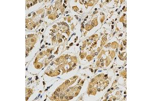 Immunohistochemistry of paraffin-embedded human stomach using PLK1 antibody at dilution of 1:200 (x400 lens) (PLK1 抗体)