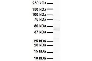 WB Suggested Anti-MCM9 antibody Titration: 1 ug/mL Sample Type: Human liver (MCM9 抗体  (N-Term))